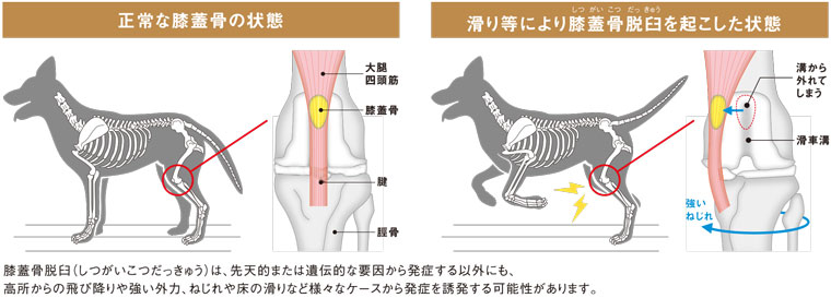 膝蓋骨脱臼の図解