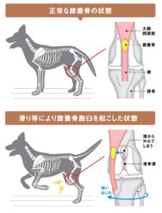 膝蓋骨脱臼の図解